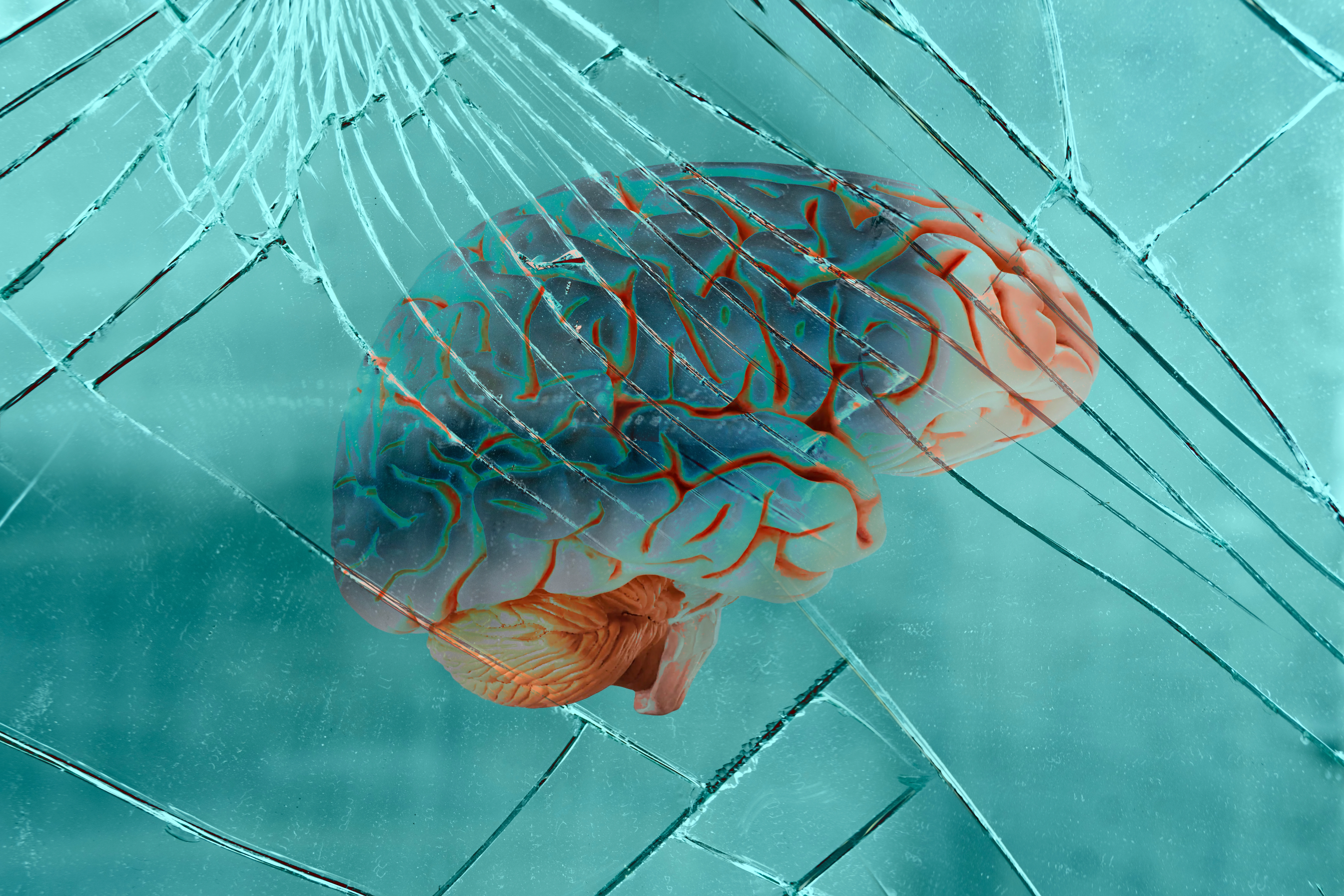 Scottsdale Traumatic Brain Injury Lawyer